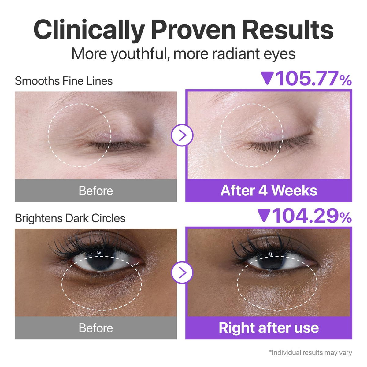 Nad+ Retinol Eye Cream