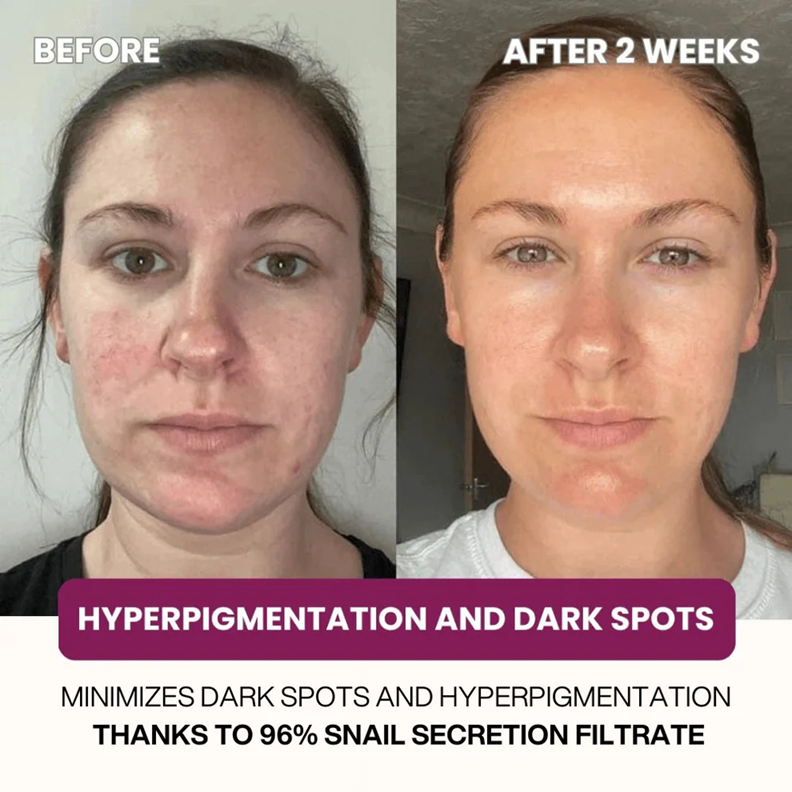 Advanced Snail 96 Mucin Face Mask