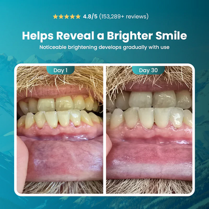 Teeth whitening gum