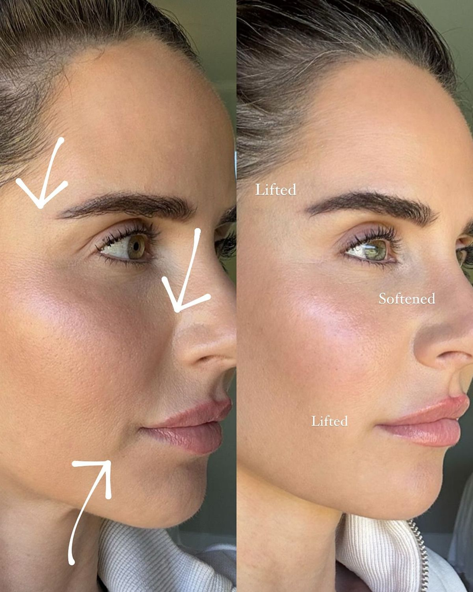 Needle-less Growth Factor Serum