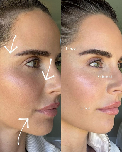 Needle-less Growth Factor Serum