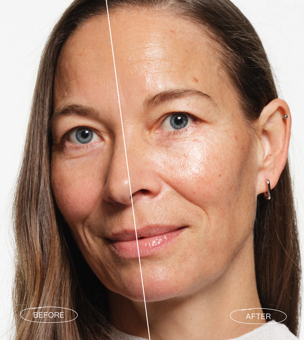 snatch it eye serum