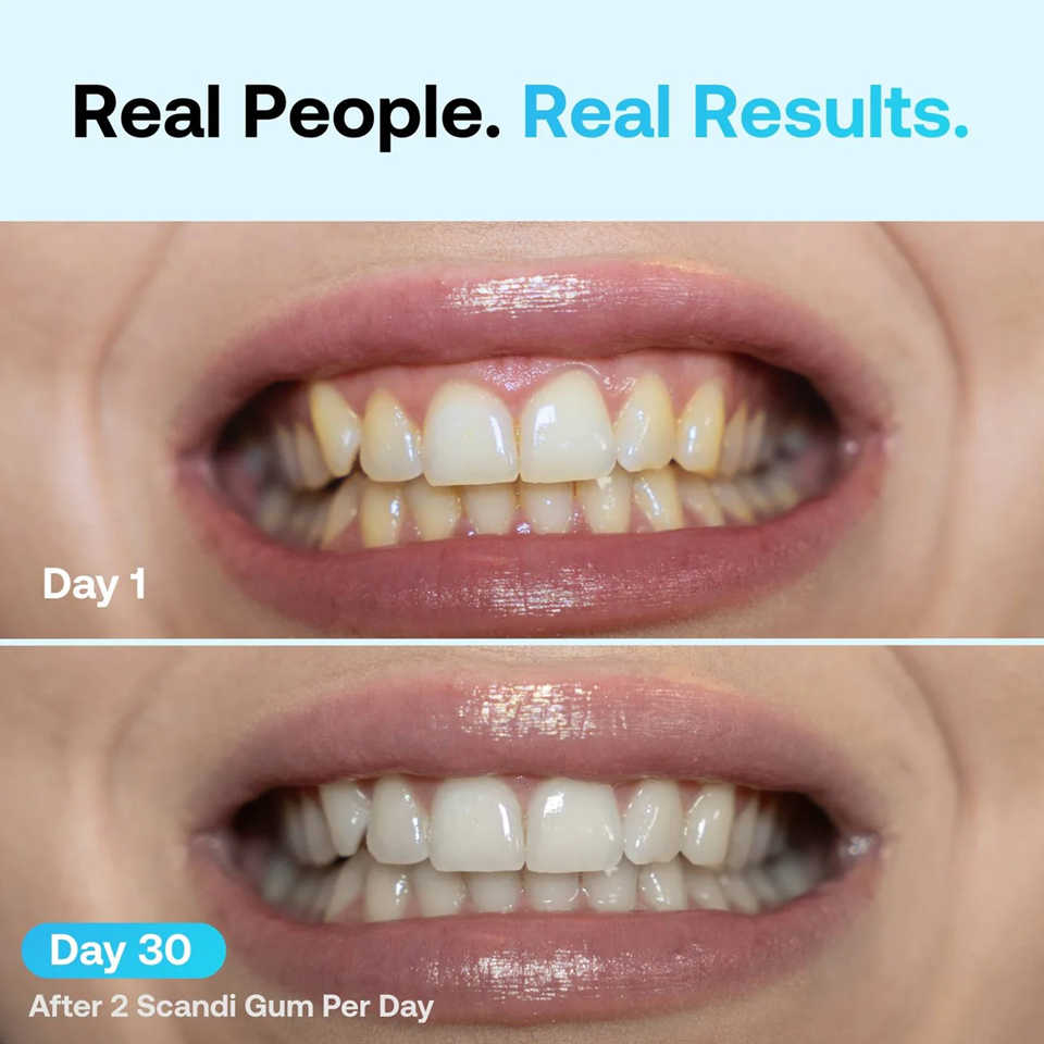 Teeth whitening gum